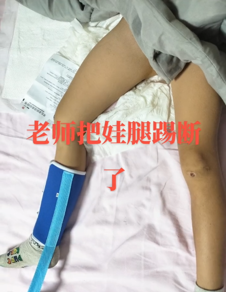 陕西周至县一学生被老师踢断腿骨？教育局：正在跟进处理1