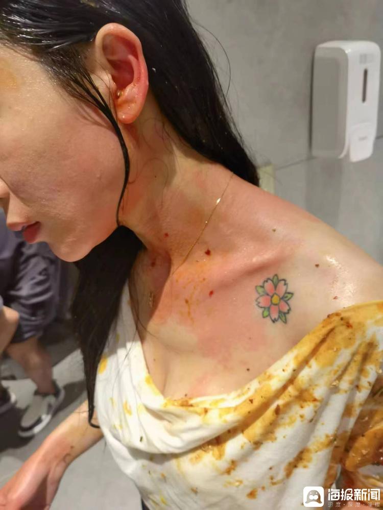 两年被家暴16次女子时隔260天再见施暴者：全程浑身发抖，左肾一直恶化3