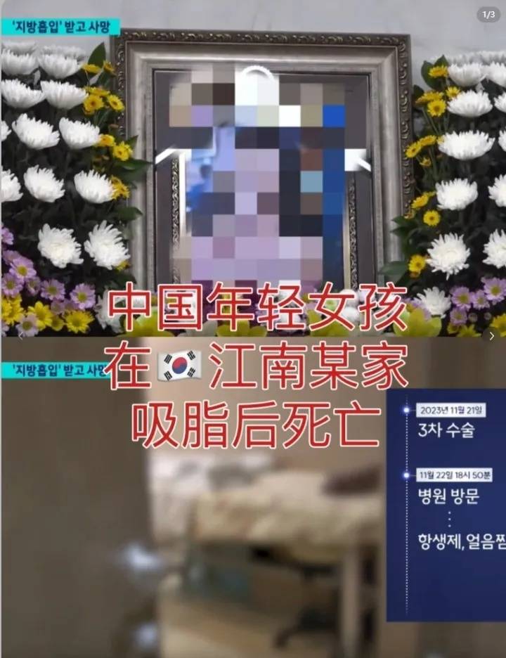 中国籍女子赴韩2周抽脂3次死亡 当地华人翻译：国内求美者赴韩普遍面临“时间紧迫”的问题6