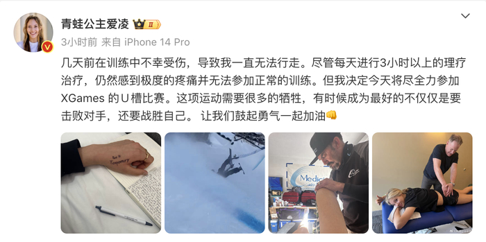谷爱凌带伤参赛夺金，此前发博称受伤无法行走，每天理疗3小时以上