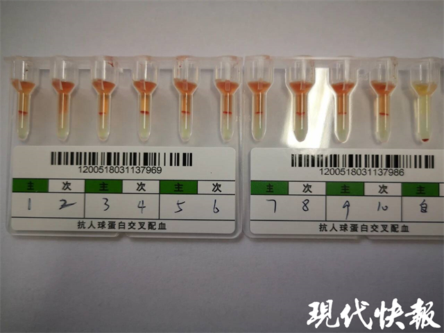 全球首个核苷酸序列！江苏泰州发现罕见小p血型，我国仅记录10余人3