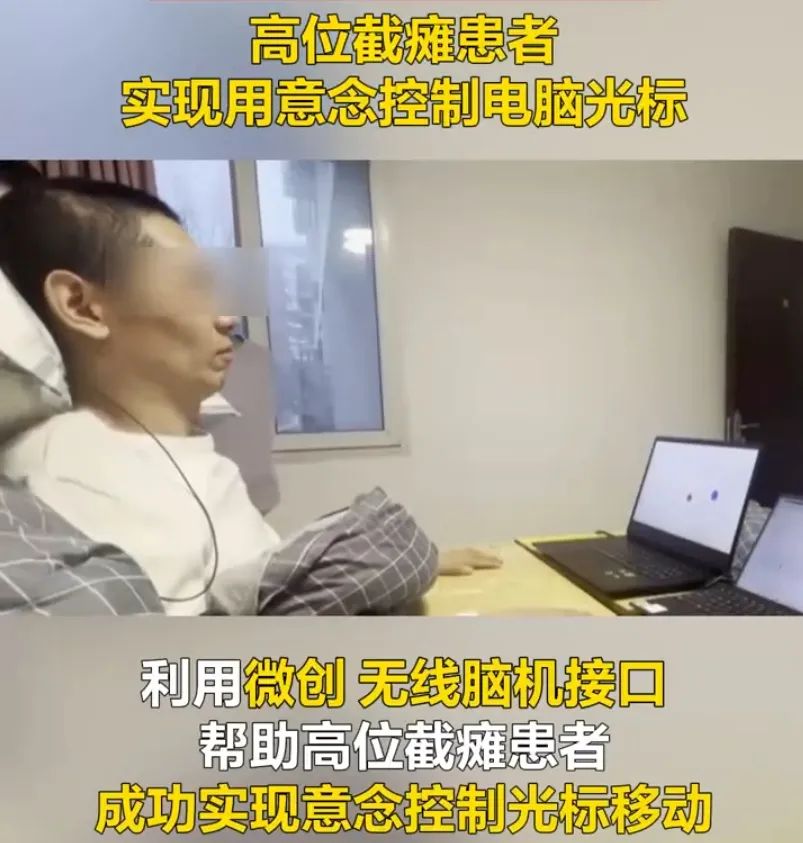 不是科幻电影！中国35岁高位截瘫患者，可以用意念控制电脑光标……1