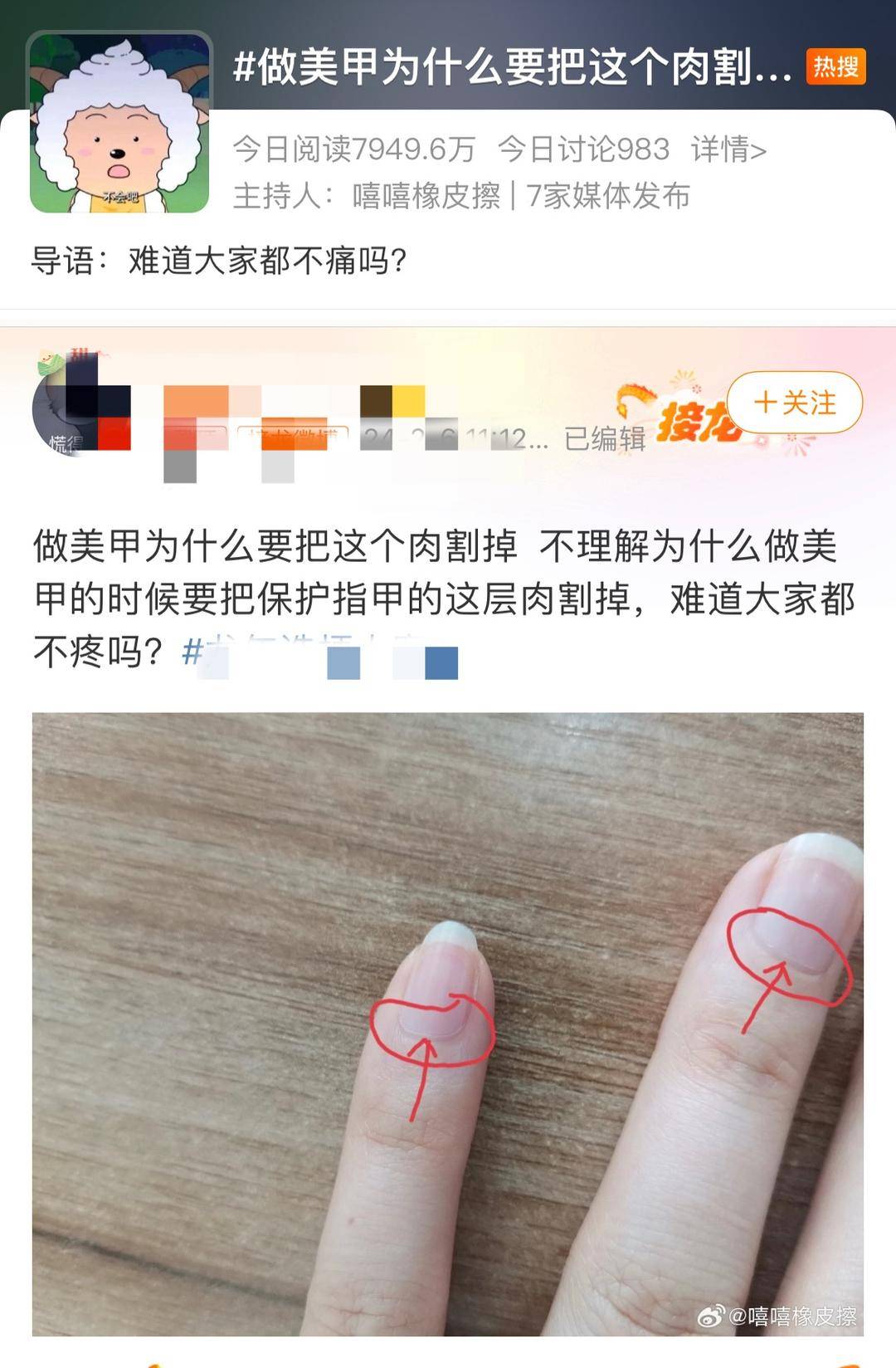 修到出血！你被美甲伤过吗？ 临近春节，想做美甲注意这三点1