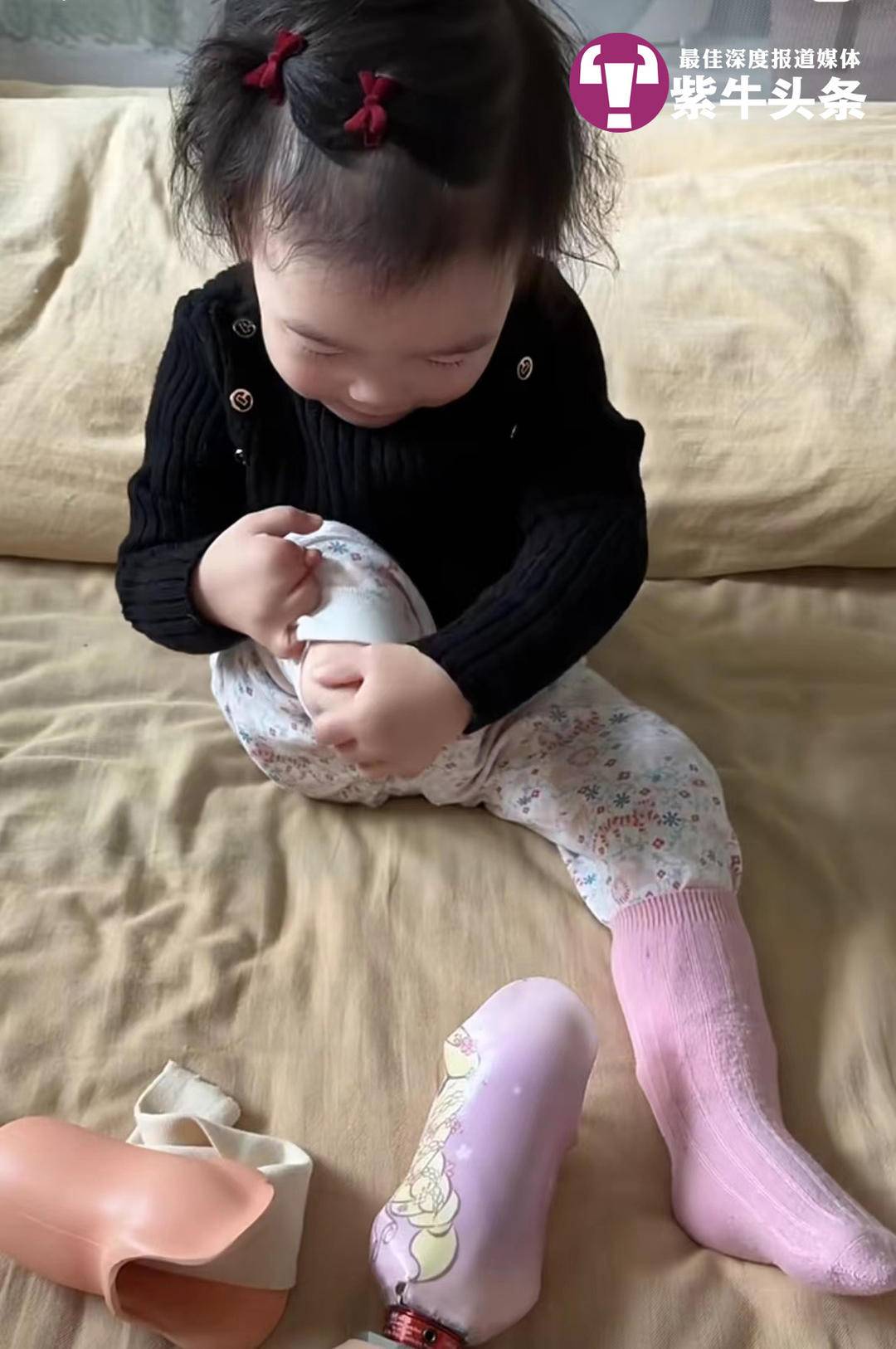 宝贝真棒！妈妈分享2岁娃独立穿戴假肢视频，网友齐喊加油1