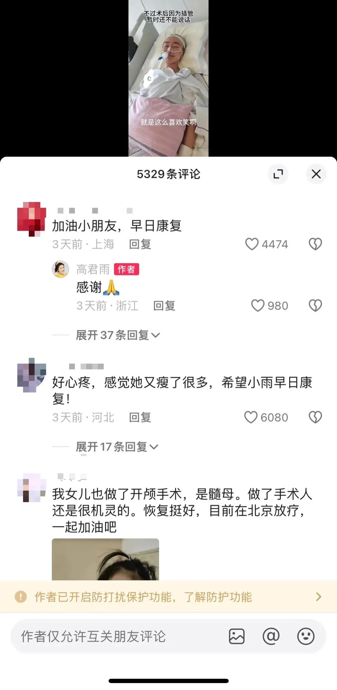 网友质疑“点读机女孩”高君雨脑瘤手术视频为“旧闻”，多方回应1