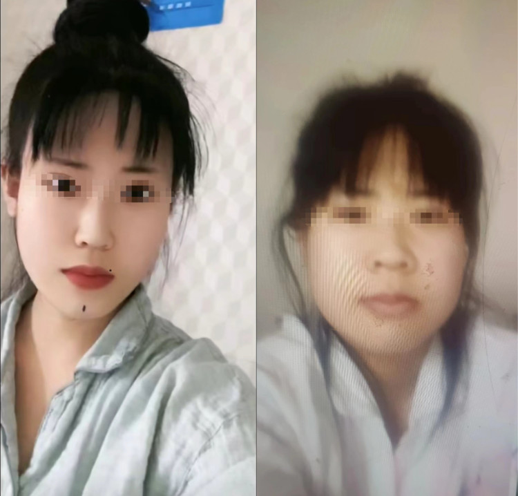 24岁女孩花21万元整形出院当天跳河自杀,医美机构称与其无直接关系1
