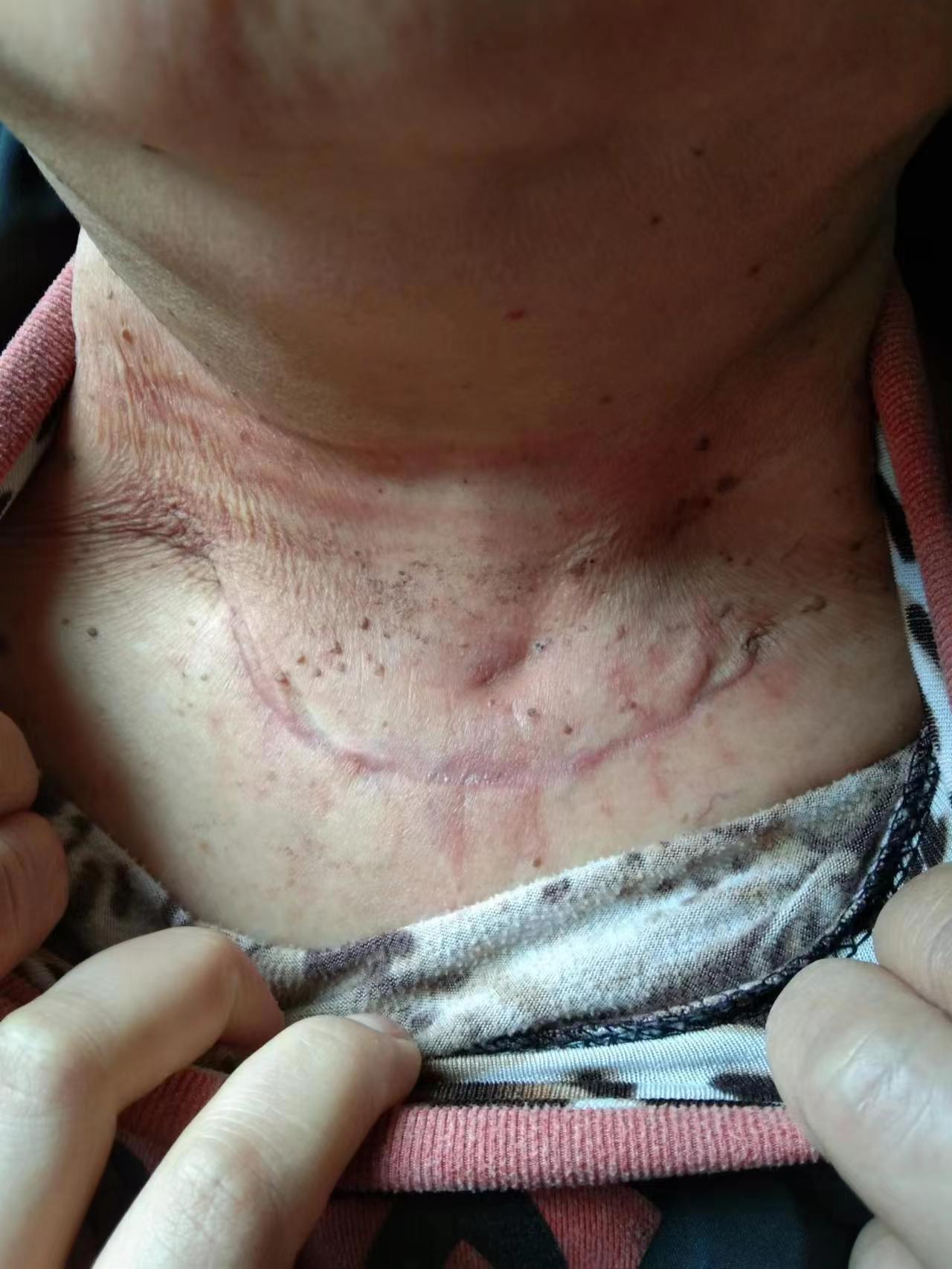 ae737365a3af14c534b01ffcdc2e81b